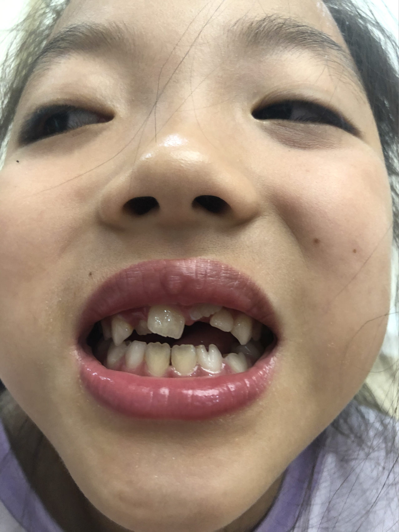 莊最新牙齒技術揭秘，牙齒美容新選擇